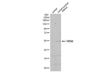 Anti-TIP60 antibody used in Western Blot (WB). GTX112197