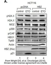 Anti-TIP60 antibody used in Western Blot (WB). GTX112198