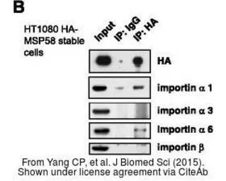 Anti-KPNA5 antibody used in Western Blot (WB). GTX112203