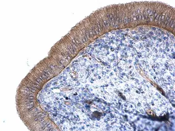 Anti-CTNNAL1 antibody [N3C2], Internal used in IHC (Paraffin sections) (IHC-P). GTX112226