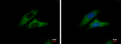 Anti-CTNNAL1 antibody [N3C2], Internal used in Immunocytochemistry/ Immunofluorescence (ICC/IF). GTX112226
