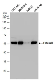 Anti-Fetuin B antibody used in Western Blot (WB). GTX112260