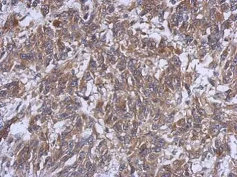 Anti-HERPUD1 antibody used in IHC (Paraffin sections) (IHC-P). GTX112261