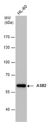 Anti-ASB2 antibody [N3C2], Internal used in Western Blot (WB). GTX112289