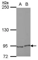 Anti-E2F8 antibody [N3C3] used in Western Blot (WB). GTX112299