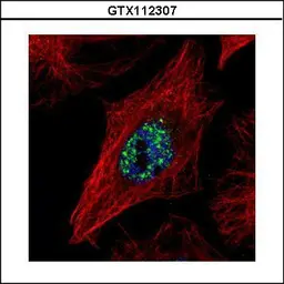 Anti-NCOA2 antibody [C2C3], C-term used in Immunocytochemistry/ Immunofluorescence (ICC/IF). GTX112307