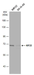 Anti-KIF22 antibody [N3C2], Internal used in Western Blot (WB). GTX112357