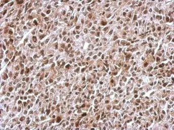 Anti-KIF22 antibody [N3C2], Internal used in IHC (Paraffin sections) (IHC-P). GTX112357