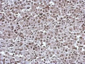 Anti-KIF22 antibody [N3C2], Internal used in IHC (Paraffin sections) (IHC-P). GTX112357