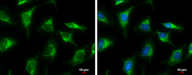 Anti-GLUD1 + GLUD2 antibody used in Immunocytochemistry/ Immunofluorescence (ICC/IF). GTX112361
