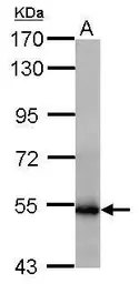 Anti-GLUD1 + GLUD2 antibody used in Western Blot (WB). GTX112361