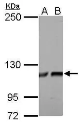 Anti-ATP citrate lyase antibody [C2C3], C-term used in Western Blot (WB). GTX112379