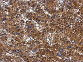 Anti-ATP citrate lyase antibody [N1N2], N-term used in IHC (Paraffin sections) (IHC-P). GTX112387