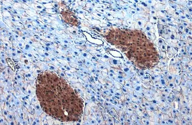 Anti-ATP citrate lyase antibody [N1N2], N-term used in IHC (Paraffin sections) (IHC-P). GTX112387