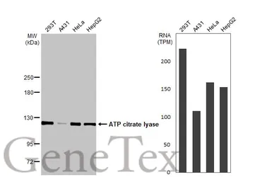 Anti-ATP citrate lyase antibody [N1N2], N-term used in Western Blot (WB). GTX112387