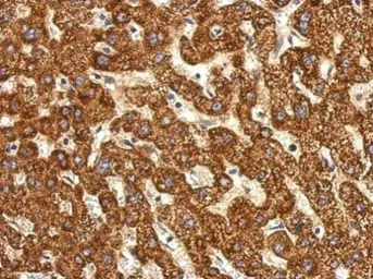 Anti-ACSL1 antibody used in IHC (Paraffin sections) (IHC-P). GTX112430