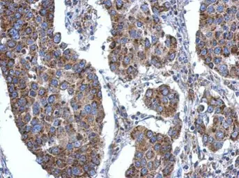 Anti-ACSL3 antibody used in IHC (Paraffin sections) (IHC-P). GTX112431
