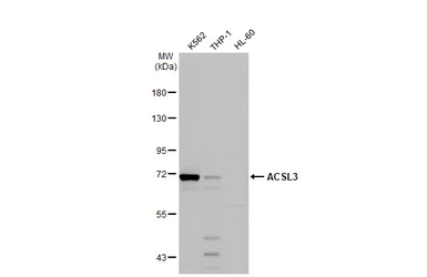 Anti-ACSL3 antibody used in Western Blot (WB). GTX112431