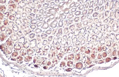 Anti-ACSL3 antibody used in IHC (Paraffin sections) (IHC-P). GTX112431
