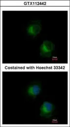 Anti-IFIT3 antibody used in Immunocytochemistry/ Immunofluorescence (ICC/IF). GTX112442