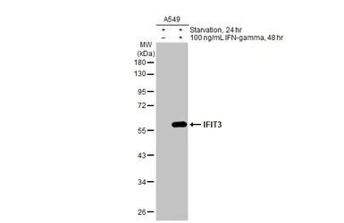 Anti-IFIT3 antibody used in Western Blot (WB). GTX112442