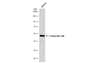 Anti-Cytokeratin 33B antibody used in Western Blot (WB). GTX112454