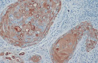 Anti-Cytokeratin 33B antibody used in IHC (Paraffin sections) (IHC-P). GTX112454