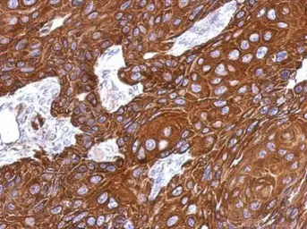 Anti-Cytokeratin 33B antibody used in IHC (Paraffin sections) (IHC-P). GTX112454