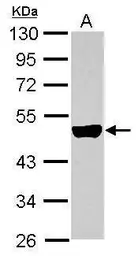 Anti-Cytokeratin 33B antibody used in Western Blot (WB). GTX112454