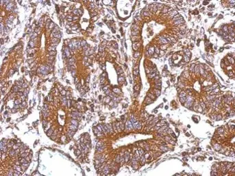 Anti-CTAGE5 antibody used in IHC (Paraffin sections) (IHC-P). GTX112467