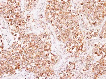 Anti-AP2B1 antibody used in IHC (Paraffin sections) (IHC-P). GTX112479