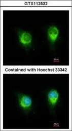 Anti-Kinectin 1 antibody [C2C3], C-term used in Immunocytochemistry/ Immunofluorescence (ICC/IF). GTX112532