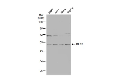 Anti-DLST antibody [N3C3] used in Western Blot (WB). GTX112555