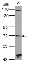 Anti-HHIP antibody [C1C3] used in Western Blot (WB). GTX112565