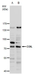 Anti-Coilin antibody used in Western Blot (WB). GTX112570