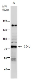 Anti-Coilin antibody used in Western Blot (WB). GTX112570