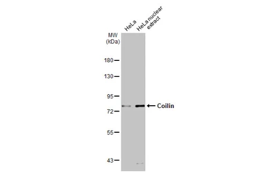 Anti-Coilin antibody used in Western Blot (WB). GTX112570