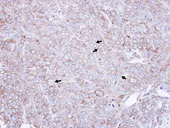 Anti-CAP1 antibody [C1C3] used in IHC (Paraffin sections) (IHC-P). GTX112578