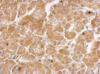 Anti-HHIP antibody [N3C2], Internal used in IHC (Paraffin sections) (IHC-P). GTX112584