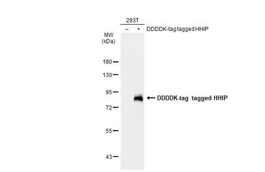 Anti-HHIP antibody [N3C2], Internal used in Western Blot (WB). GTX112584