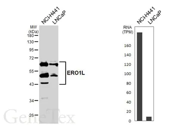 Anti-ERO1L antibody used in Western Blot (WB). GTX112589