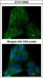 Anti-p23 antibody [N1C3-2] used in Immunocytochemistry/ Immunofluorescence (ICC/IF). GTX112655