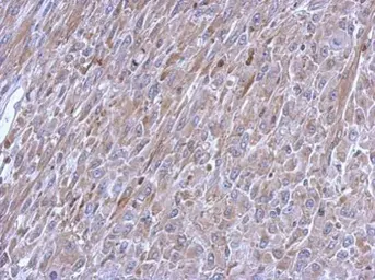 Anti-beta Tubulin antibody used in IHC (Paraffin sections) (IHC-P). GTX112658