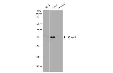 Anti-Vimentin antibody used in Western Blot (WB). GTX112661
