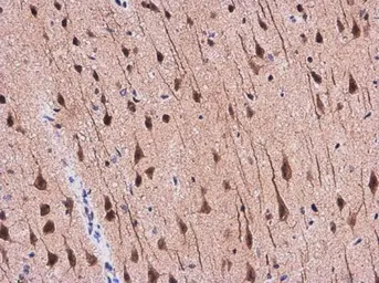 Anti-APP antibody used in IHC (Paraffin sections) (IHC-P). GTX112677