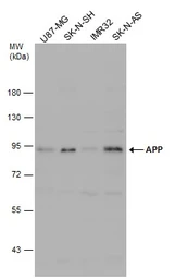 Anti-APP antibody used in Western Blot (WB). GTX112677