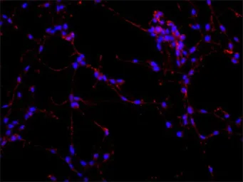 Anti-MAP2 antibody [AP-20] used in Immunocytochemistry/ Immunofluorescence (ICC/IF). GTX11268