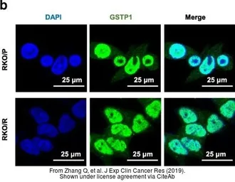 Anti-GSTP1 antibody used in Immunocytochemistry/ Immunofluorescence (ICC/IF). GTX112695