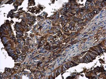 Anti-alpha 1 Antitrypsin antibody [N1C2] used in IHC (Paraffin sections) (IHC-P). GTX112707