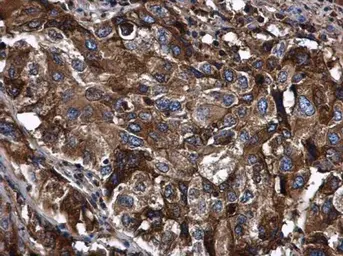 Anti-alpha 1 Antitrypsin antibody [N1C2] used in IHC (Paraffin sections) (IHC-P). GTX112707
